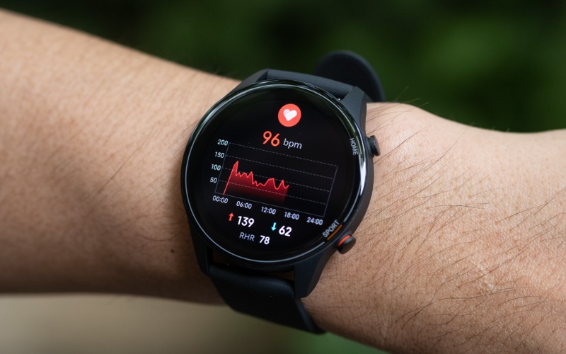 Đồng hồ thông minh Xiaomi Watch