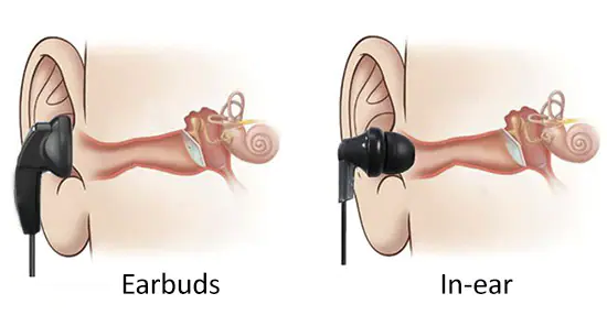ưu điểm của tai nghe in ear